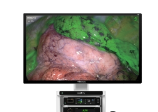 UX5 Series 4K/NIR & HyPixel U1 Endoscope